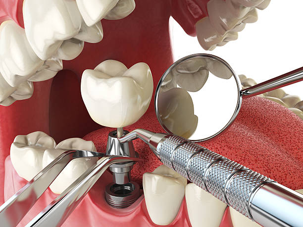 Best Emergency Orthodontic Repairs in Squirrel Mountain Valley, CA